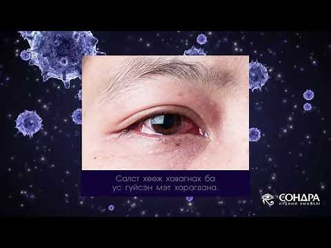 ТА НҮДНИЙ ХАНИАДНЫ ТАЛААР ХЭР МЭДЛЭГТЭЙ ВЭ?