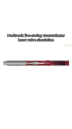 How Medtronic Engineers Advance Heart Valve Innovation