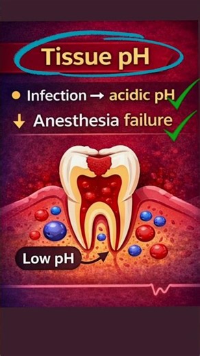Factors Affecting Local Anesthetics | Dental Viva Trick | BDS Exam short notes #shorts