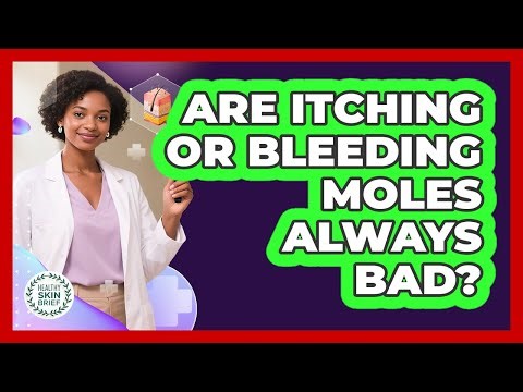Are Itching or Bleeding Moles Always Bad?