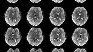 Brain Mapping: From the Basics to Science Fiction | KQED