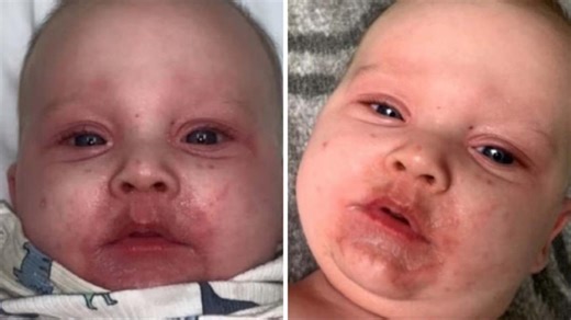 Queensland family enacts 'Ryan's Rule' after sick baby misdiagnosed at hospital