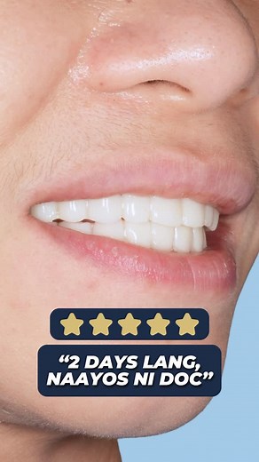 Proud patient moment! We delivered her brand-new set of dentures right on time before she left the Philippines. We made sure everything matched exactly what she requested for the look and feel she wanted. At Bucad, we listen, customize, and deliver solutions that fit every patient’s needs. FOR APPOINTMENTS & INQUIRIES 📍 Visit us: Unit 1621, 16th Floor, Centuria Medical Makati 📞 Call or Text: 0917-876-8963 | 0917-108-1528 💬 For consultations: message us at facebook.com/drbucadvisionandsmilereh