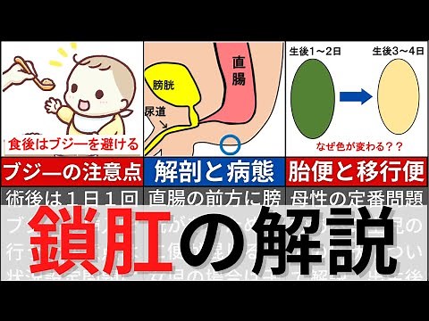 [7-minute explanation, 13-minute national exam question] Explanation of imperforate anus