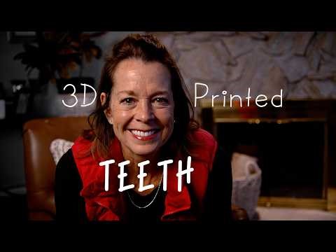 Jean can't believe her new SMILE │ the Four Ever Smile