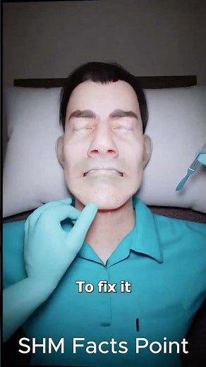 "How an Elongated Uvula Is Treated | Uvuloplasty Explained" #shortsfeed #shorts #trending #ytshorts