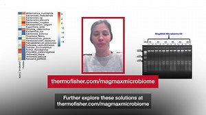 4K views · 25 reactions | Purify microbiome nucleic acids with the Applied Biosystems MagMAX Microbiome Ultra kit. | Thermo Fisher Scientific | Facebook