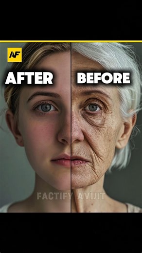 Why does skin sag over time?