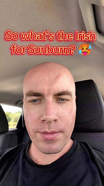 Learn the Irish Word for Sunburn: Dó Gréine