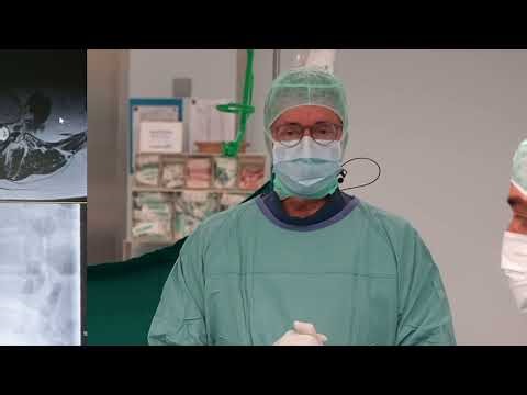Foraminal Approach L4-L5 - Full-endoscopic spine surgery performed by Prof. Dr. Sebastian Rütten