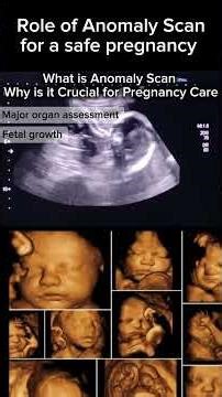 Understanding Anomaly Scan & its Importance in Pregnancy #health #ultrasound ⁨@Dr.Saimakhan