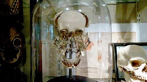 Exploded human skull in a bell-jar