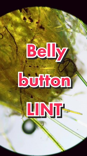 Exploring Belly Button Lint Under a Microscope