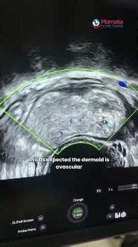 Multiple Causes Of Infertility Found In One Ultrasound! | Mamata Fertility Hospital: Hyderabad