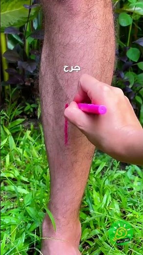 نصائح بسيطة للعناية بالجروح في المنزل 🩹✨