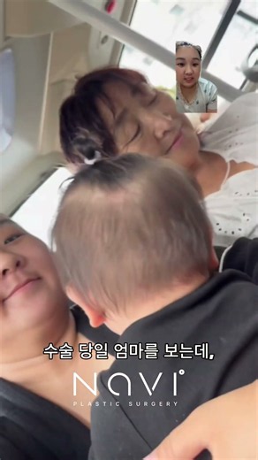 중년성형 트렌트 상안검 하안검?