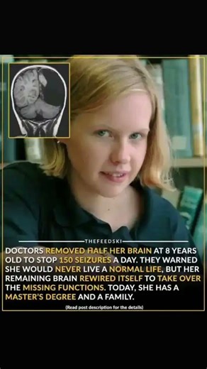 read description for full story #fact #shorts