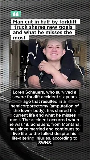 He Survived Being Cut In Half 😱 | Loren Schauers Story