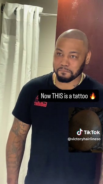 Scalp Micropigmentation for Black Men's Hairlines