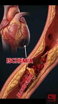 Cardiac Conduction System explained #shorts #heart #cardiology