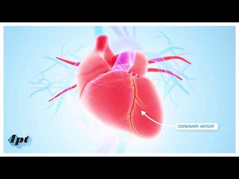 What happens during Myocardial Infarction