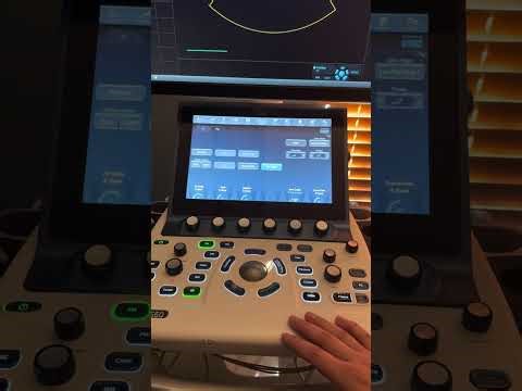 GE S60 Ultrasound Machine Basic User Guide