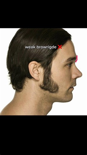 Brow Ridge Transformation in 90 Days