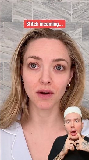 HOW TO GET RID OF ECZEMA!😱 #eczema #skincareproducts #skincaretips #skin #skincareroutine