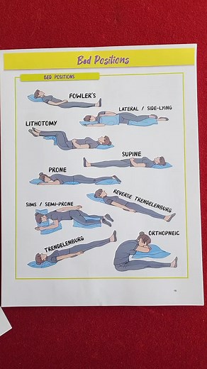 Fundamentals of Nursing: Bed Positions #nursingschool #nursingstudent #nursingschoolhacks #newgradnurse #nurse #nurselife #nurseproblems #rn #bsn #lpn #nclex #nclexrn #nclextips #nclexprep #study #nursingexam #fyp #foryou #nursingexamsuccess #nursingstudyguides