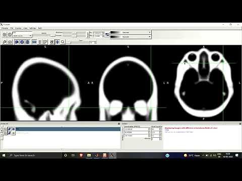 Segmentation of Gray Matter White Matter and CSF | SPM | MATLAB | Resting-state fMRI | Preprocessing