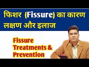 What are Fissure Causes Symptoms and Treatment & How to Diagnose it...