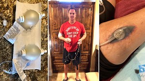 Defenders: Central Texas man’s story added to growing list highlighting dangers of compounded drugs