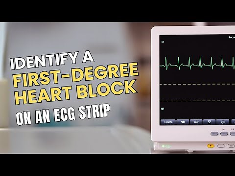 How to Identify a First-Degree Heart Block on an ECG Strip