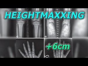 How To Reach Your Full Height Potential (Heightmaxxing)