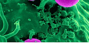 Cancer Metastasis Caught on Film | Cancer