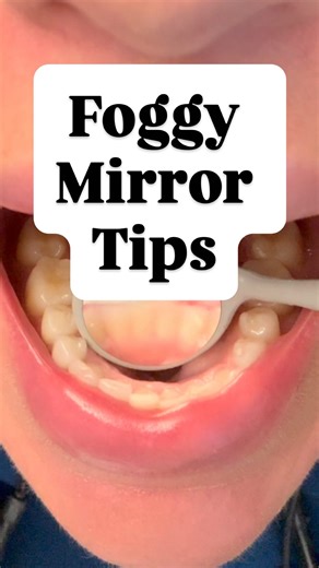 Stephanie Botts•Dental and Office Ergonomics Specialist on Instagram: "These tips + link can help 👇 I have found wiping on the patients cheek CAN help, but it doesn’t last long. Using the polish trick from @hygieneedge is a great option, just be sure to use FINE grit and don’t do it all the time so you don’t wear out your mirrors. For an everyday, long lasting defogger I use the Mirror Magic system from @zircdentalproducts - it’s super convenient and lasts a long time, plus when using the wipe