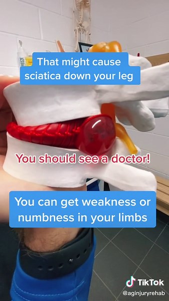 Understanding Slipped Disc: Causes, Symptoms, and Treatment Options