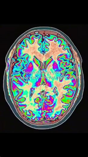 Neuroplasticity prove your brain can change.Your habits and thoughts reshape your neural connection.