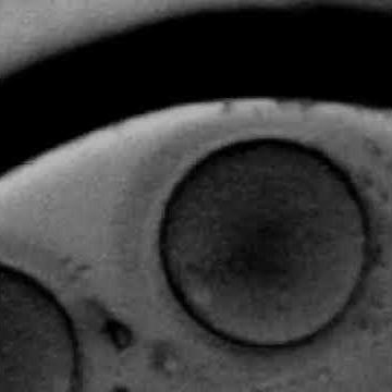 Rotation of the blastomeres at 4cells human embryo.avi