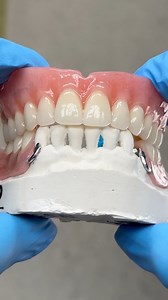 475K views · 1.5K reactions | Upper Denture and Lower Partial! Case from Dr. GR Birdwell in Tennessee! GR Birdwell Family Dental Care | Luke Kahng | Facebook