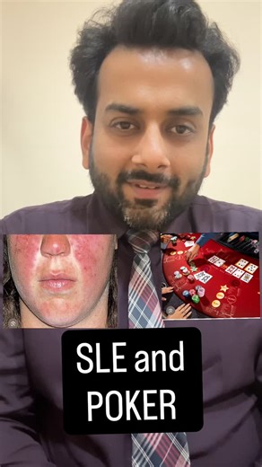 Vivek Goel on Instagram: "In lupus nephritis, sometimes the kidney biopsy shows a “full house” — not a poker win, but a red flag 🚩 IgG, IgA, IgM, C3, C1q all lining up like a perfect poker hand. In cards it means jackpot, in nephrology it means immune complex overload and active disease. Know the difference. Play the right game. ♠️🃏 #LupusNephritis #FullHouseEffect #RenalPathology #NephrologyTeaching #viveknephrologygoel"