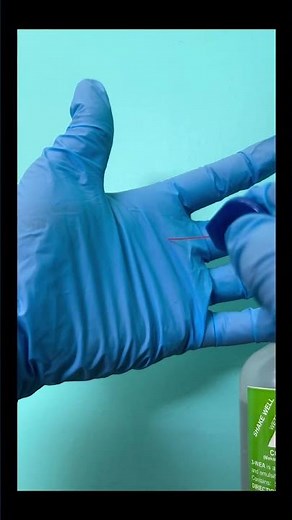 Semmes–Weinstein (10 g) monofilament 👉 Ver descripción/ see description