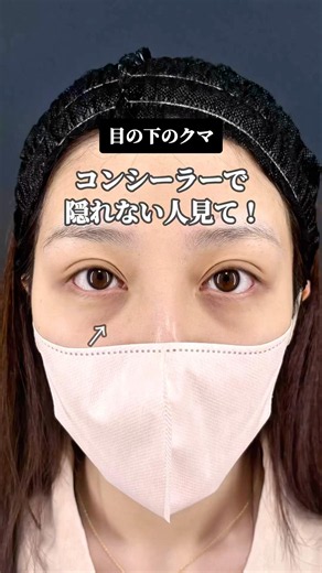 【目の下のクマ】コンシーラーで隠れない人見て！！#shorts #美容整形 #美容師 #整形 #クマ取り