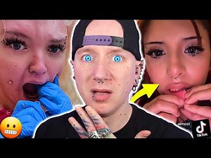 These Cheek Piercings Are Rotting In Her Face!