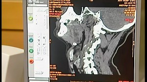 【CT诊断学】骨关节与软组织CT读片指导1