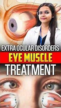 Eye Muscle Disorders: Causes, Symptoms & Treatment