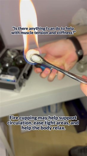 Like any treatment, cupping works best when combined with movement and an individualized care plan ✨