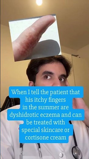 Tiny, intensely itchy blisters on your fingers during the summer? ☀️ You might be dealing with