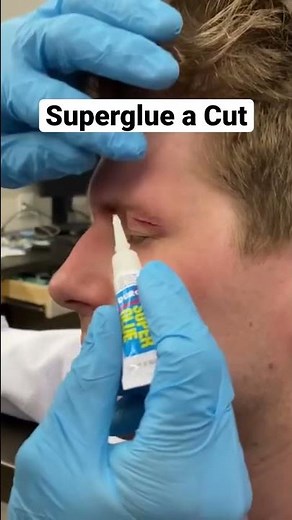 How to Superglue a Cut-BJJ Gym Fix #shorts #bjj #superglue #cut #GymFix
