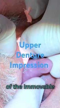 Taking a denture impression.